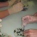 dissection SVT (13)